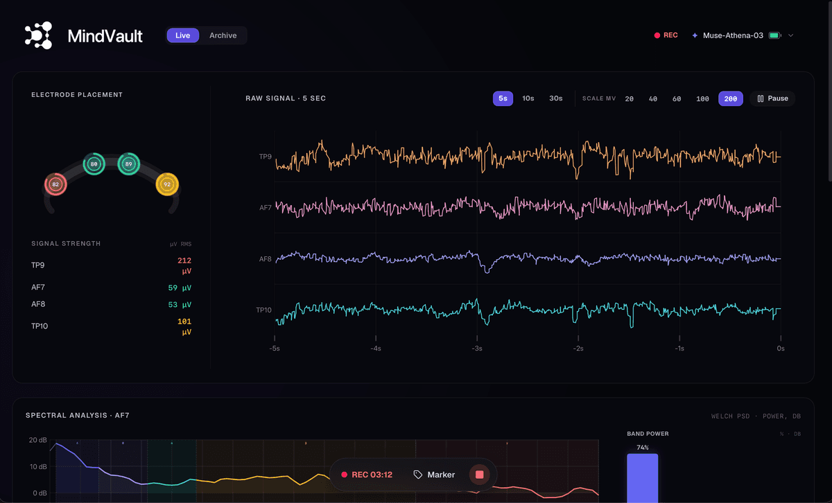 Live EEG on the desk: electrodes and raw signal
